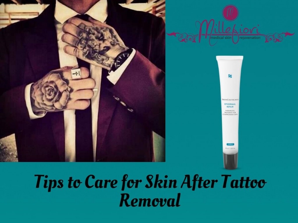 tattoo removal tags downtown melbourne epidermal reapair laser tattoo ...